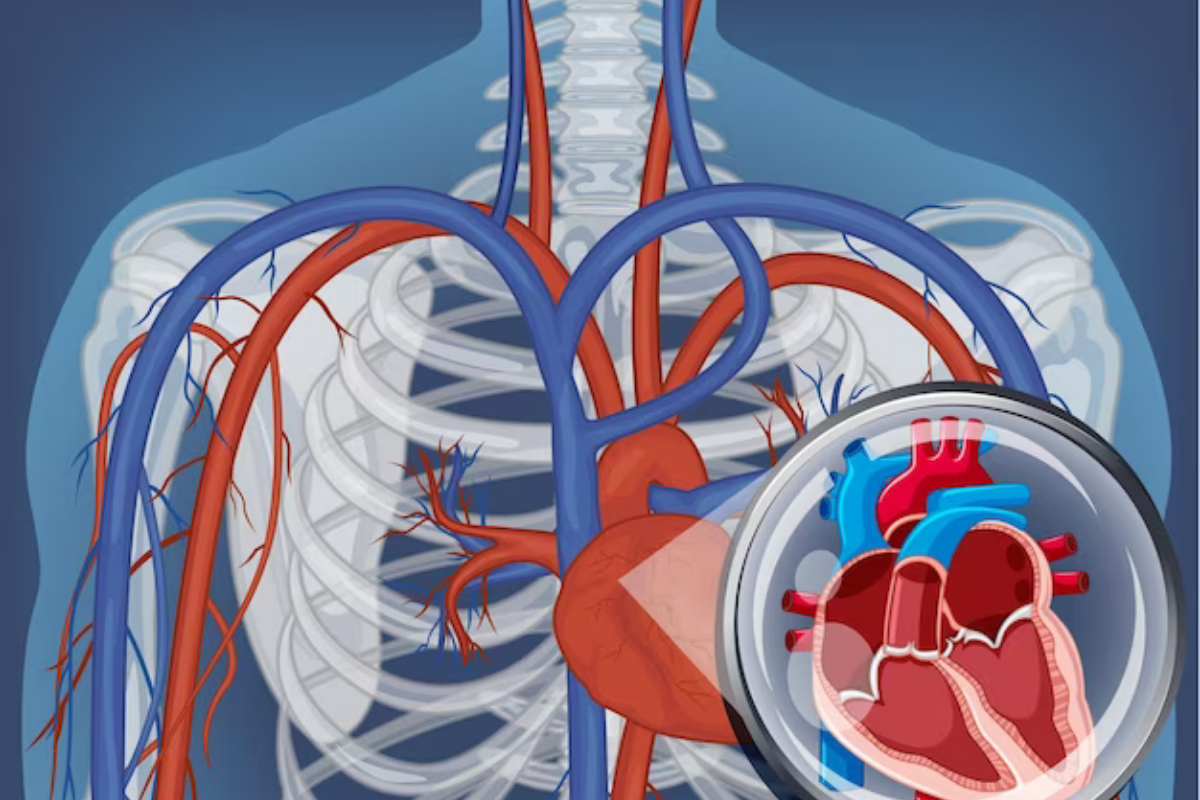 Coronary angiography