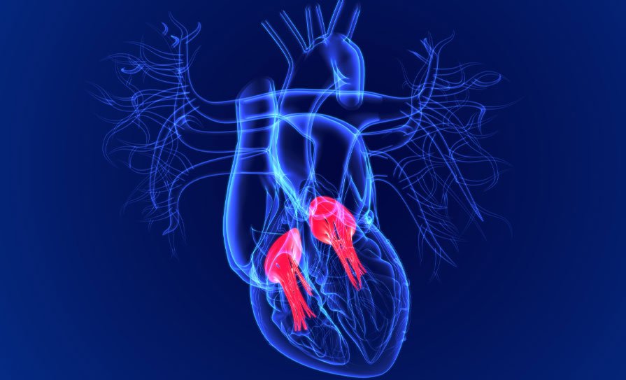 Understanding Heart Valve Disease